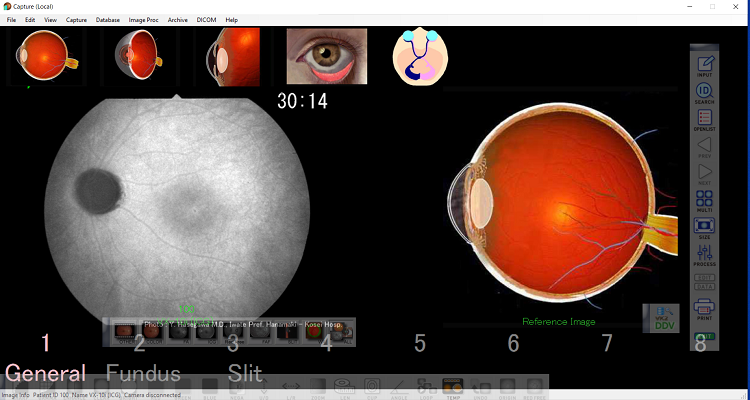 Reference (Template) image